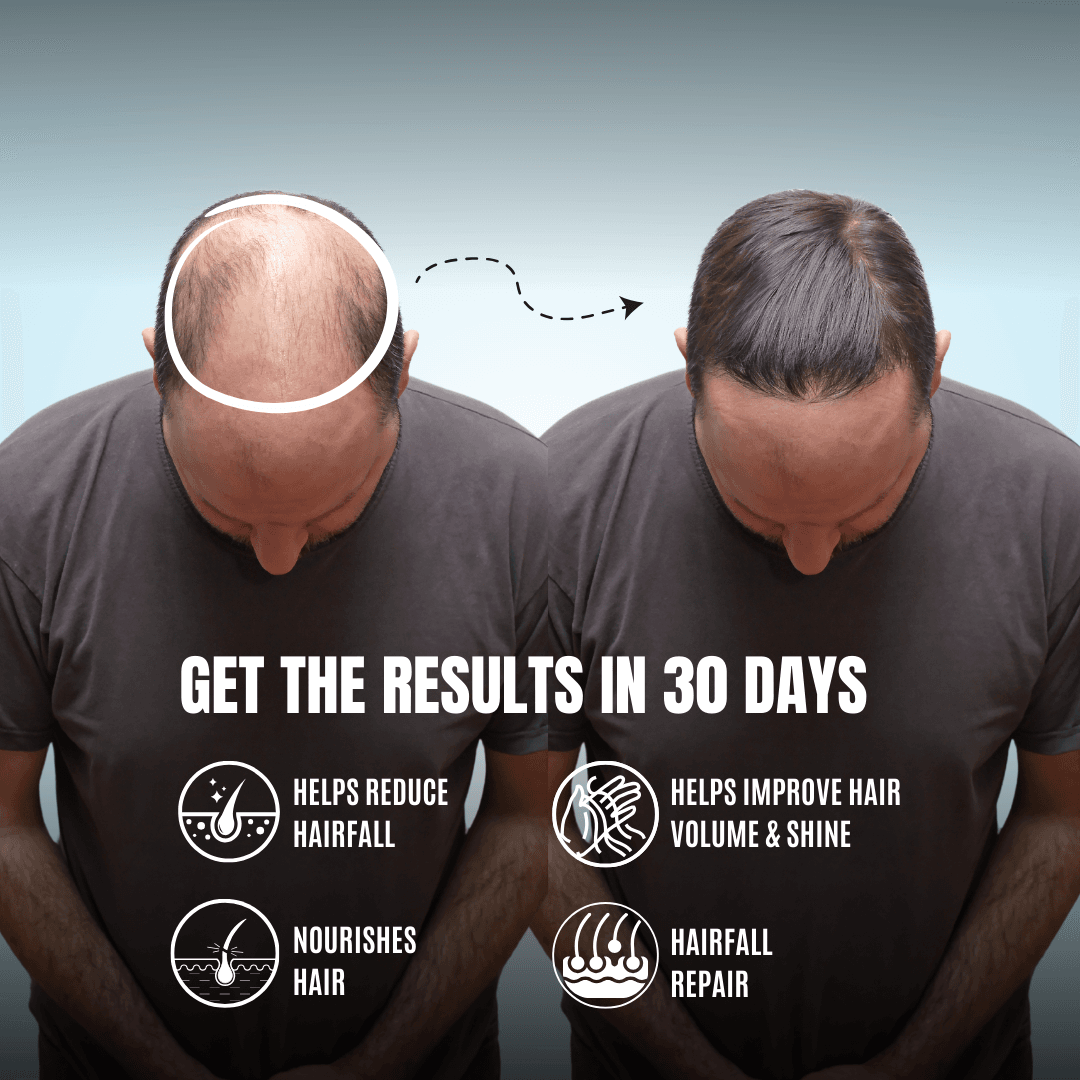 HairBliss Oil - Image 6