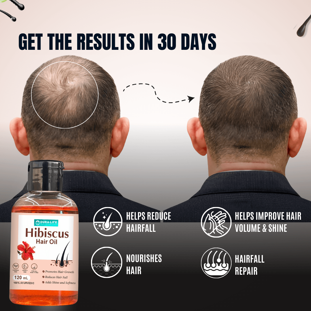 Hibiscus Hair Oil - Image 4